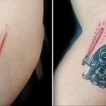 Можно ли сделать татуировку на рубце 20 - 230824 tatufoto.com 20