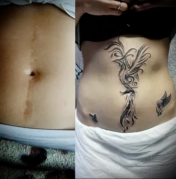 Можно ли сделать татуировку на рубце 22 - 230824 tatufoto.com 22