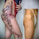 Можно ли сделать татуировку на рубце 23 - 230824 tatufoto.com 23