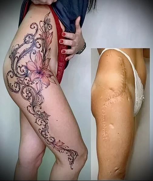 Можно ли сделать татуировку на рубце 23 - 230824 tatufoto.com 23