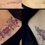 Можно ли сделать татуировку на рубце 27 - 230824 tatufoto.com 27