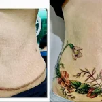Можно ли сделать татуировку на рубце 4 - 230824 tatufoto.com 04