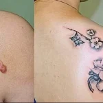 Можно ли сделать татуировку на рубце 5 - 230824 tatufoto.com 05