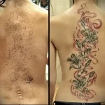 Можно ли сделать татуировку на рубце 7 - 230824 tatufoto.com 07