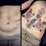 Можно ли сделать татуировку на рубце 8 - 230824 tatufoto.com 08