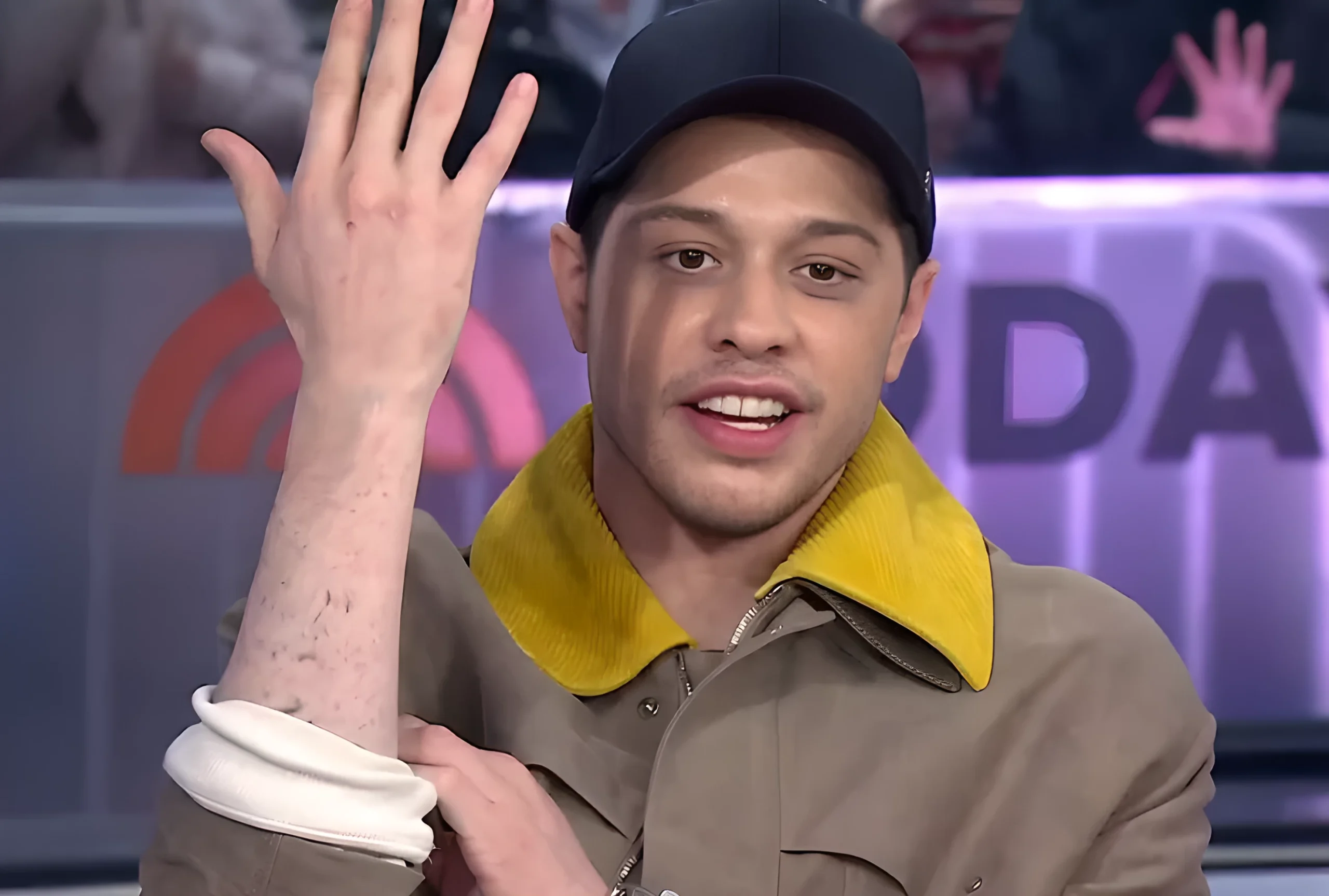 Пит Дэвидсон удаляет все татуировки за 200 000 04.02.25 №01 - tatufoto.com
