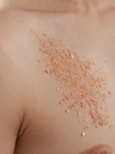 Фото татуировки в процессе заживления: кожа после снятия корочек, покраснение и небольшая шелушение.