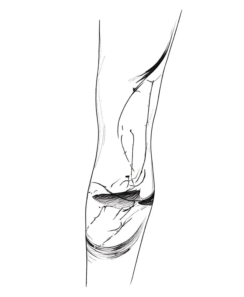 Black and white calf tattoo sketch depicting an opening lotus flower, done in graphic style with an emphasis on lines and shadows.