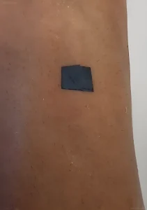 Крупный план квадратного черного электронного патча (e-tattoo) на коричневой коже, демонстрирующего технологию сбора энергии и мониторинга здоровья.
